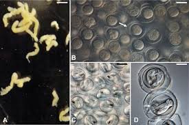 Attēlu rezultāti vaicājumam “Nematomorpha”