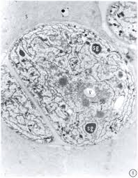 Attēlu rezultāti vaicājumam “Nostoc pruniforme cells”