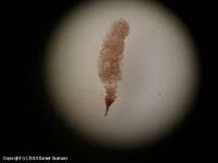 Attēlu rezultāti vaicājumam “Arcyria affinis spores”