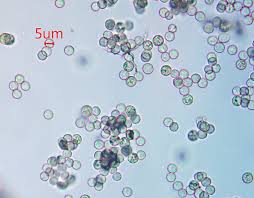 Attēlu rezultāti vaicājumam “Stemonitopsis hyperopta var. landewaldii”