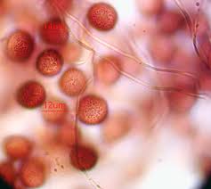 Attēlu rezultāti vaicājumam “Diderma roanense”