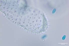 Attēlu rezultāti vaicājumam “Ceratiomyxa morchella spores”