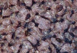 Attēlu rezultāti vaicājumam “Lycogala persicum”