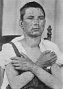 10 Illnesses And Their Effects On History