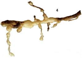 Attēlu rezultāti vaicājumam “Athelia pyriformis”