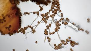 Attēlu rezultāti vaicājumam “Lamproderma pulchellum spores”