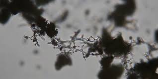 Attēlu rezultāti vaicājumam “Physarum luteolum”