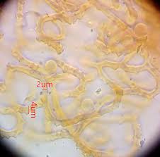Attēlu rezultāti vaicājumam “Heterotrichia insignis (syn. Arcyria insignis)”
