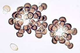 Attēlu rezultāti vaicājumam “Tranzschelia pruni-spinosae spores”