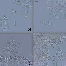 Attēlu rezultāti vaicājumam “Hymenoscyphus imberbis”