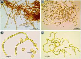 Attēlu rezultāti vaicājumam “Lycogala cf. oleocrystalliferum sessile”