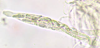 Attēlu rezultāti vaicājumam “Lasiosphaeria ovina”