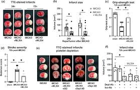 Image result for The 3E`s Ttc