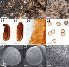Attēlu rezultāti vaicājumam “Licea pusilla spores”