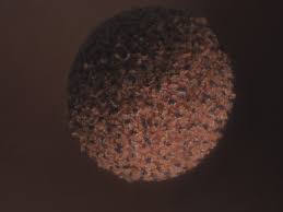 Attēlu rezultāti vaicājumam “Cribraria piriformis macro”