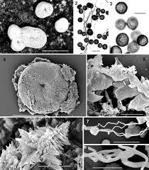 Attēlu rezultāti vaicājumam “Didymium squamulosum spores”