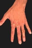 Image result for Lewandowsky-Lutz