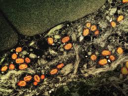 Image result for Withins Tc