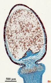 Attēlu rezultāti vaicājumam “Sphagnum sporophyte”