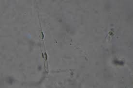 Attēlu rezultāti vaicājumam “Ombrophila violacea”