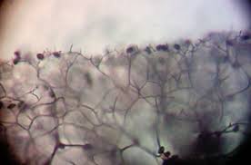 Attēlu rezultāti vaicājumam “Lycogala fuscoolearium young”