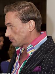After: Dr Christian Jessen had a hair implant operation four years ago, but his hair began thinning even more after pneumonia so he had another - article-2324274-19C59678000005DC-974_634x846