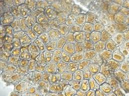 Attēlu rezultāti vaicājumam “Puccinia agrostidis”