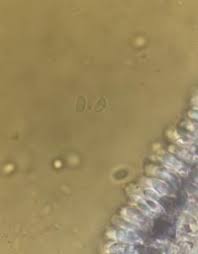 Attēlu rezultāti vaicājumam “Mucronella calva”