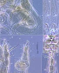 Attēlu rezultāti vaicājumam “Licea castanea sessile”