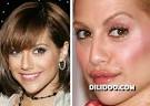 When plastic surgery fails (38 pics) - Izismile.