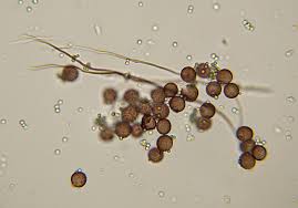 Attēlu rezultāti vaicājumam “Diderma spumarioides”