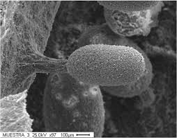 Attēlu rezultāti vaicājumam “Diachea subsessilis stalked”