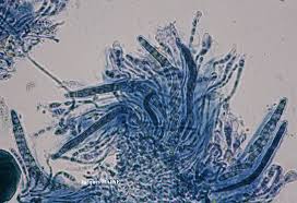 Attēlu rezultāti vaicājumam “Coenogonium pineti”