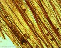 Attēlu rezultāti vaicājumam “Physarum pezizoideum”