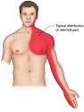<b>Angina Pectoris</b> Definition