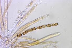 Attēlu rezultāti vaicājumam “Hypocrea gelatinosa”