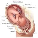 The Road to VBA3C: How to check your cervix!