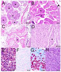 Attēlu rezultāti vaicājumam “Diderma subviridifuscum var. macrospora* sessile”