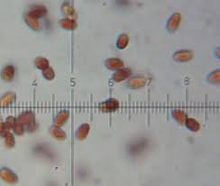 Attēlu rezultāti vaicājumam “Sarcoporia polyspora”