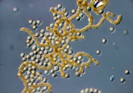 Attēlu rezultāti vaicājumam “Perichaena corticalis”