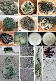 Attēlu rezultāti vaicājumam “Heterotrichia oerstedii (syn. Arcyria oerstedii) macro”