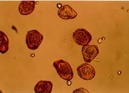 Attēlu rezultāti vaicājumam “Gymnosporangium sabinae”