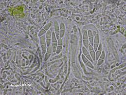 Attēlu rezultāti vaicājumam “Cliostomum corrugatum”