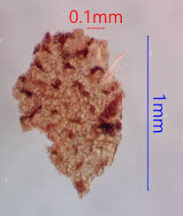 Attēlu rezultāti vaicājumam “Lycogala ustulatum”
