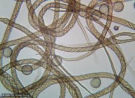 Attēlu rezultāti vaicājumam “Hemitrichia decipiens young”