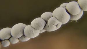 Attēlu rezultāti vaicājumam “Diderma roanense spores”