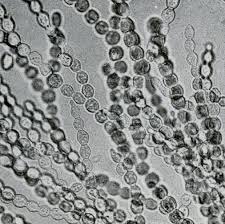 Attēlu rezultāti vaicājumam “Badhamia juliae spores”