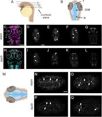 Attēlu rezultāti vaicājumam “Pseudobryum cinclidioides cells”