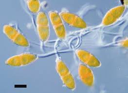 Attēlu rezultāti vaicājumam “Gymnosporangium sp.”