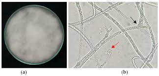 Attēlu rezultāti vaicājumam “Diderma radiatum spores”